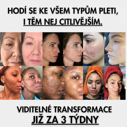 Cotons Glow Up — Proti tmavým skvrnám s Kurkumou & Kojickou kyselinou
