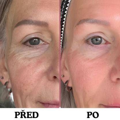 Instalift - anti-aging tyčinka na obličej