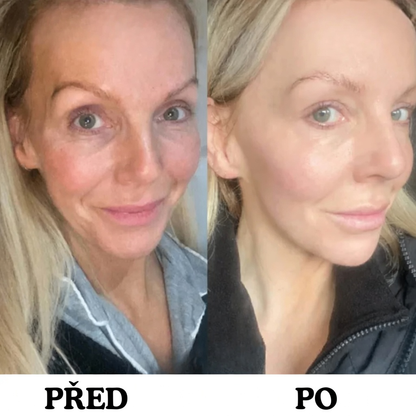 Instalift - anti-aging tyčinka na obličej
